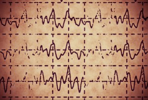 brain wave on electroencephalogram EEG for epilepsy, illustration grunge background